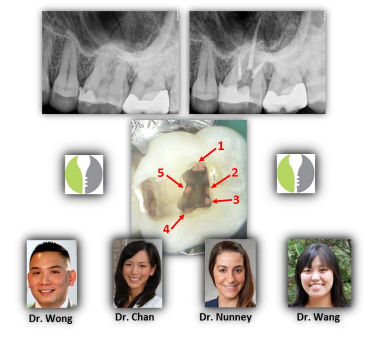 Dental Anatomy Assisted Magnification Renovo Endodontic Studio