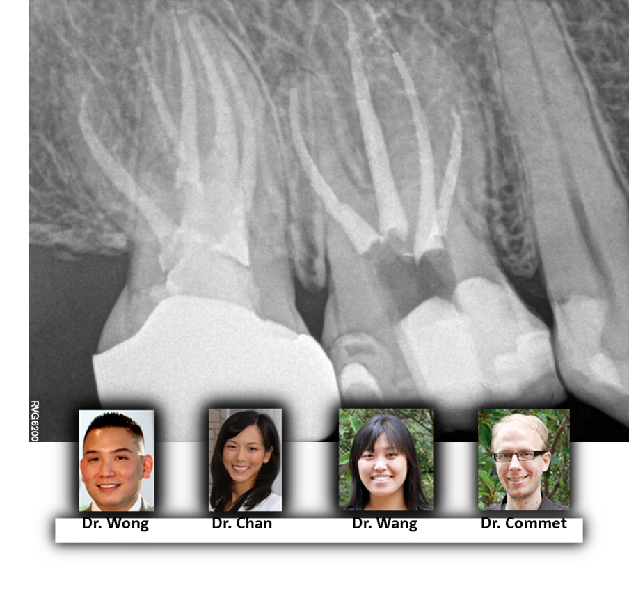 X-rays of dental anatomy