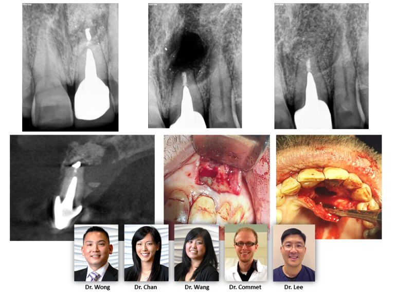 X-rays and images of CBCT Imaging