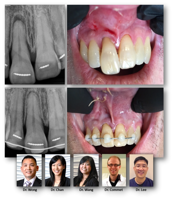 facial-trauma