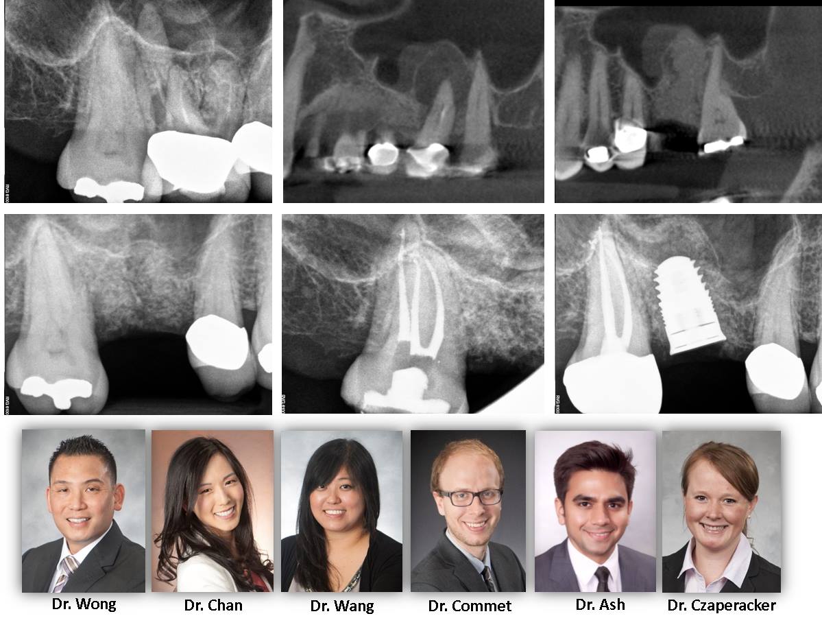 Implant and Endodontic Repair