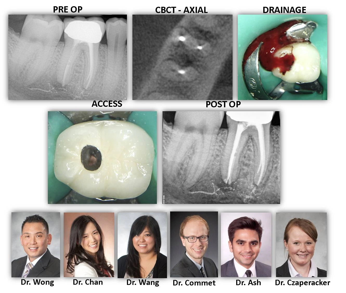 Dental-emergency