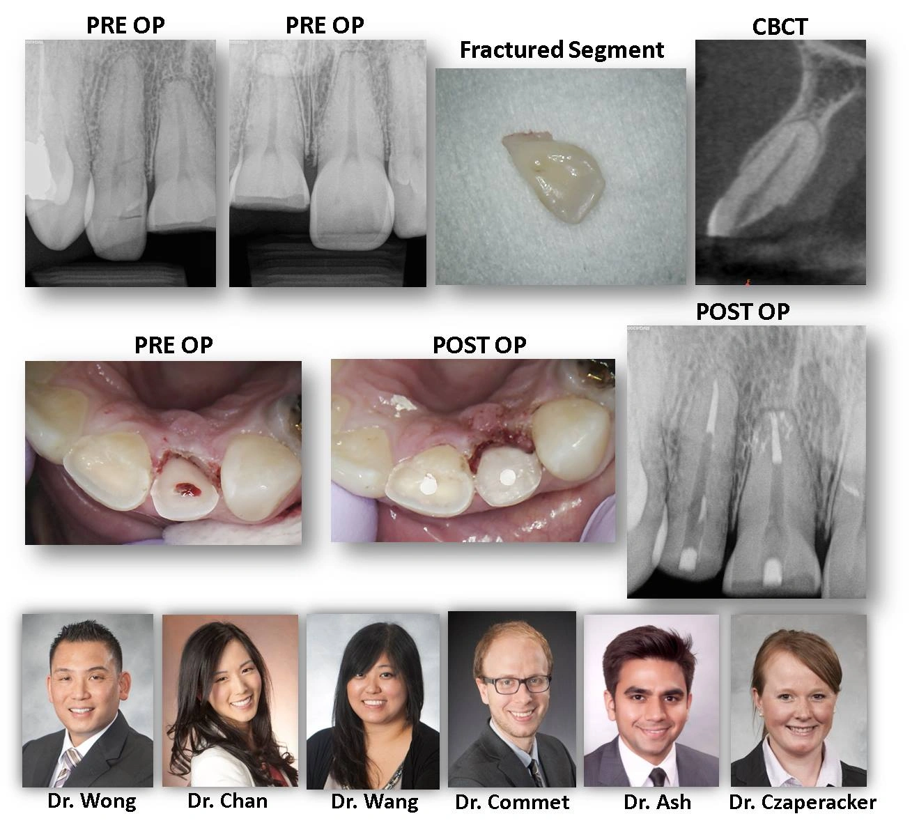 CBCT_Trauma