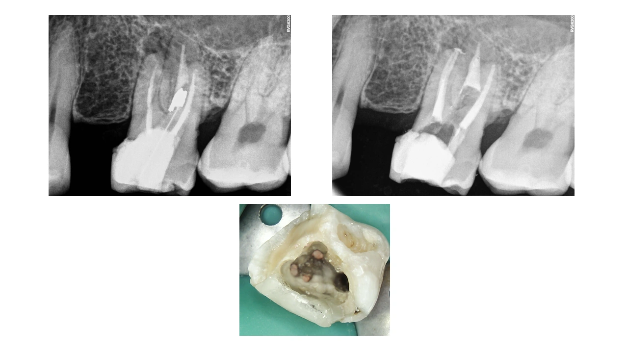 Pre-Op-Assessment