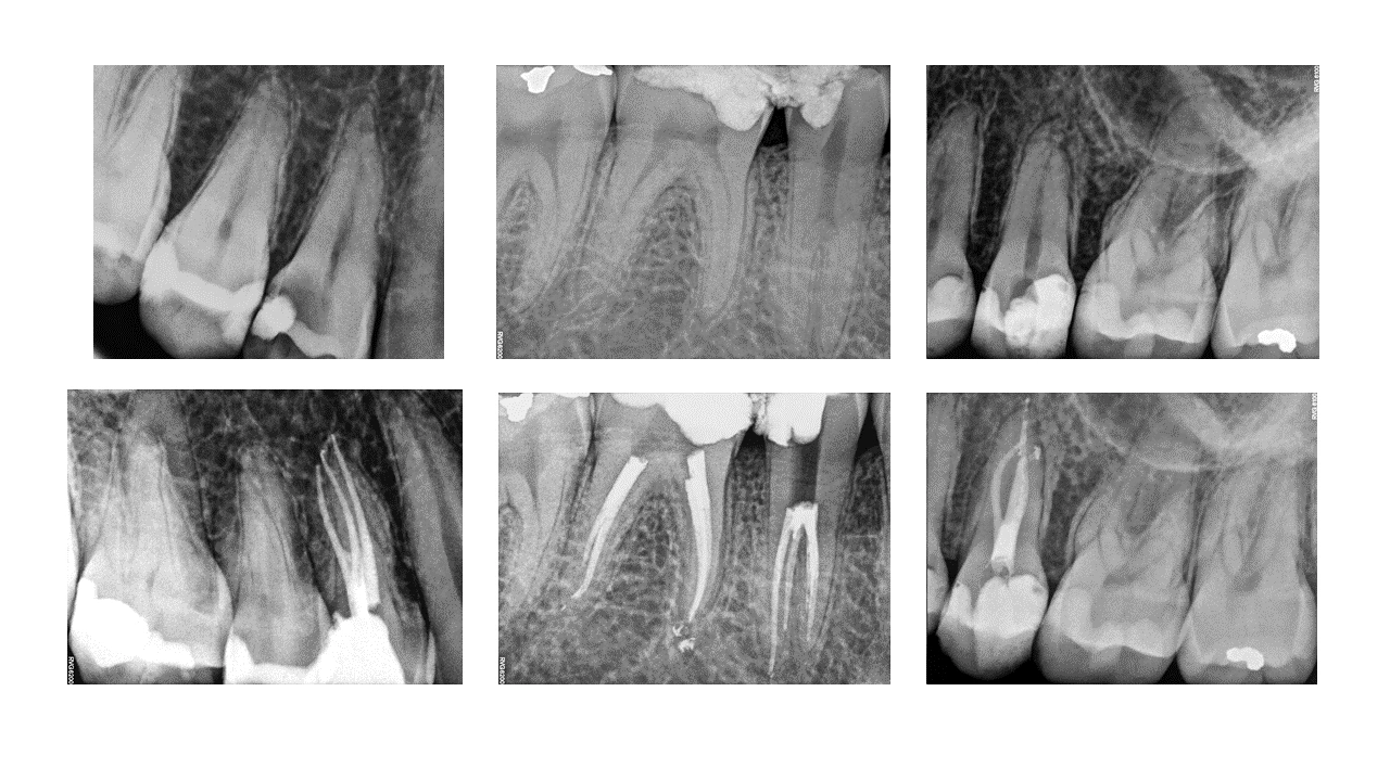 Three_teeth