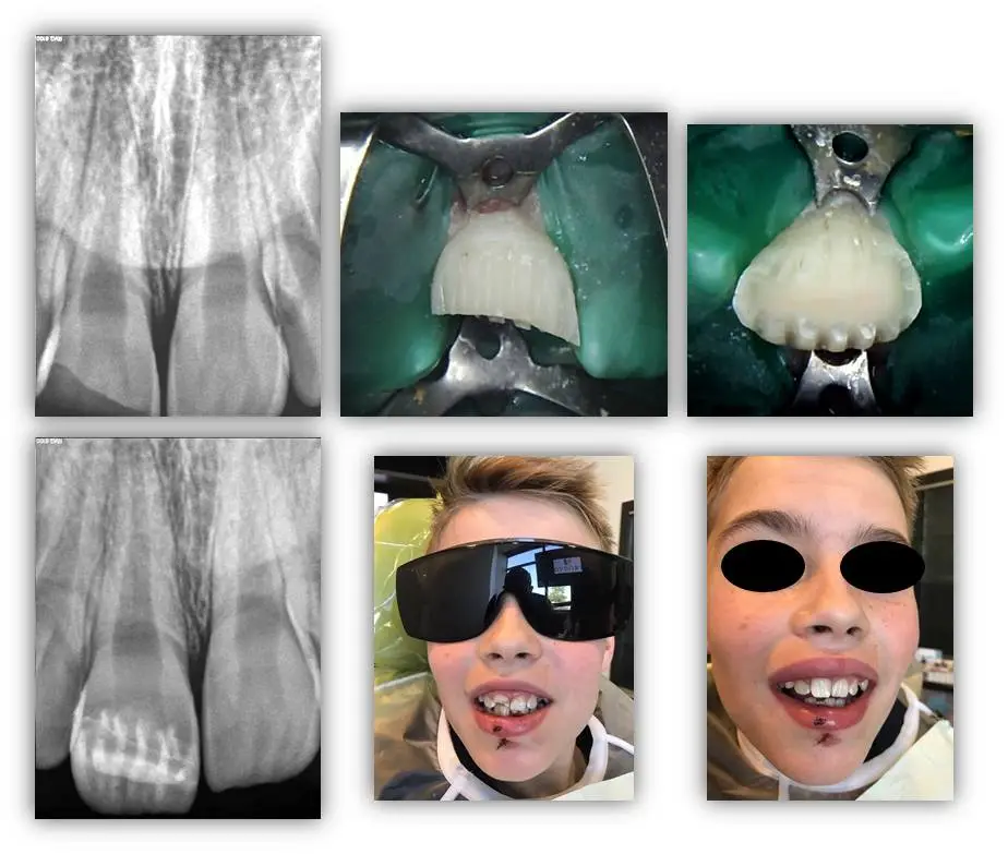 dentaltrauma
