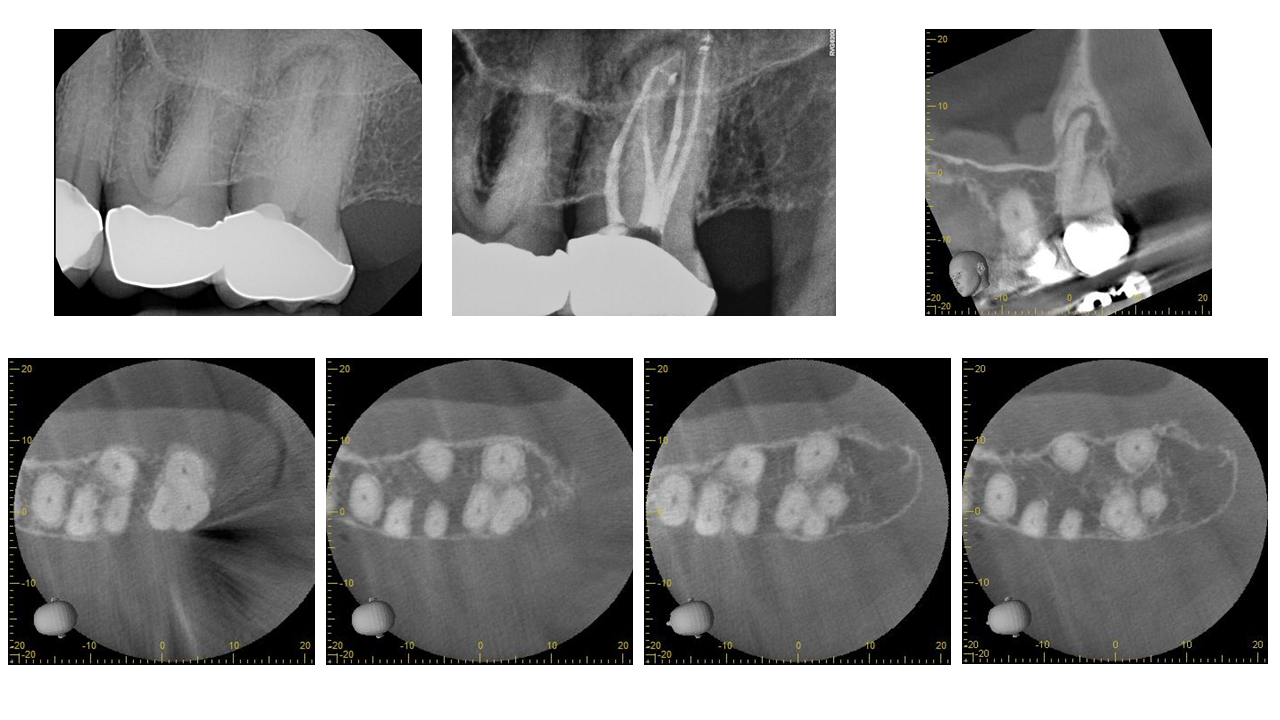 What You Didn't Know About Molar Anatomy