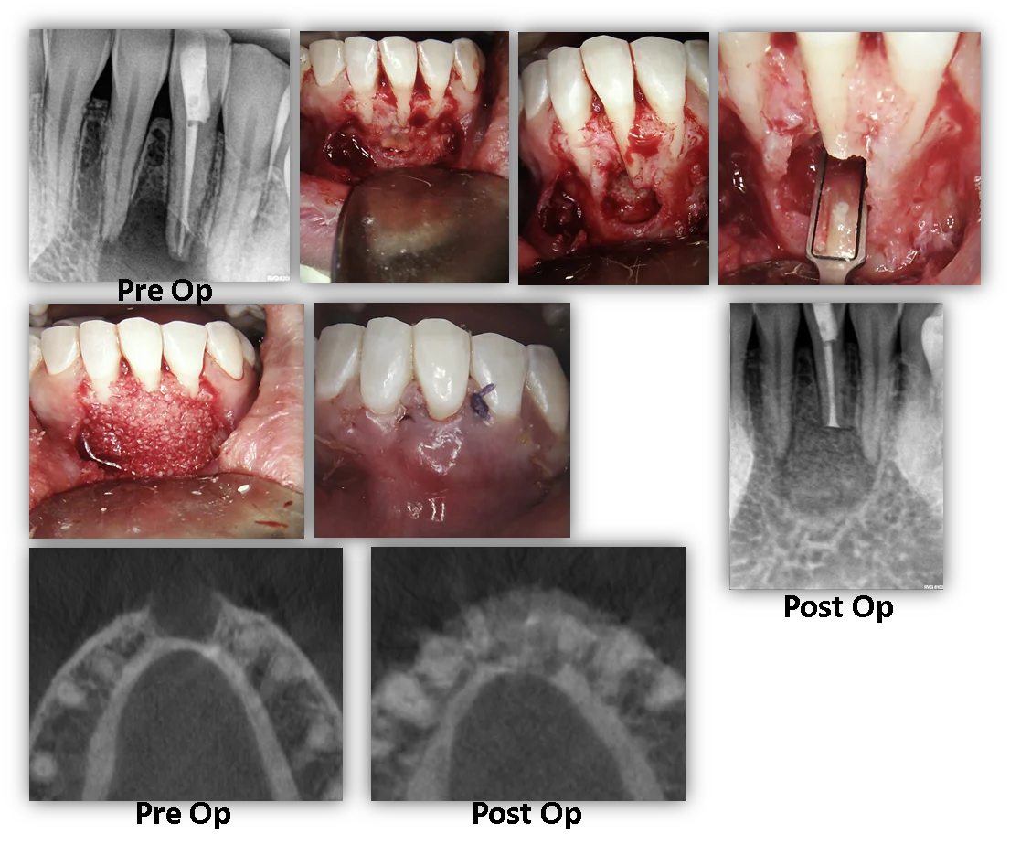 endodonticsurgery