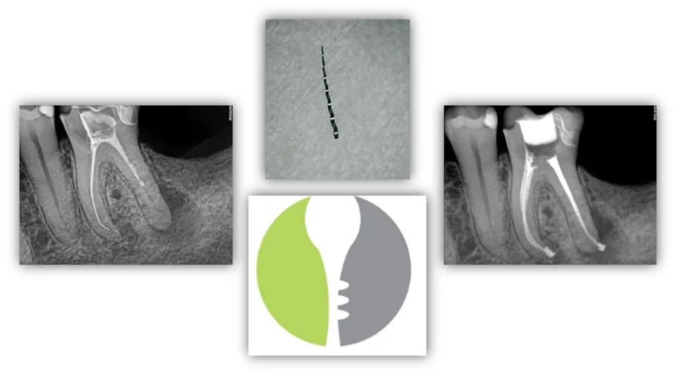 Instrumental-Removal-Image