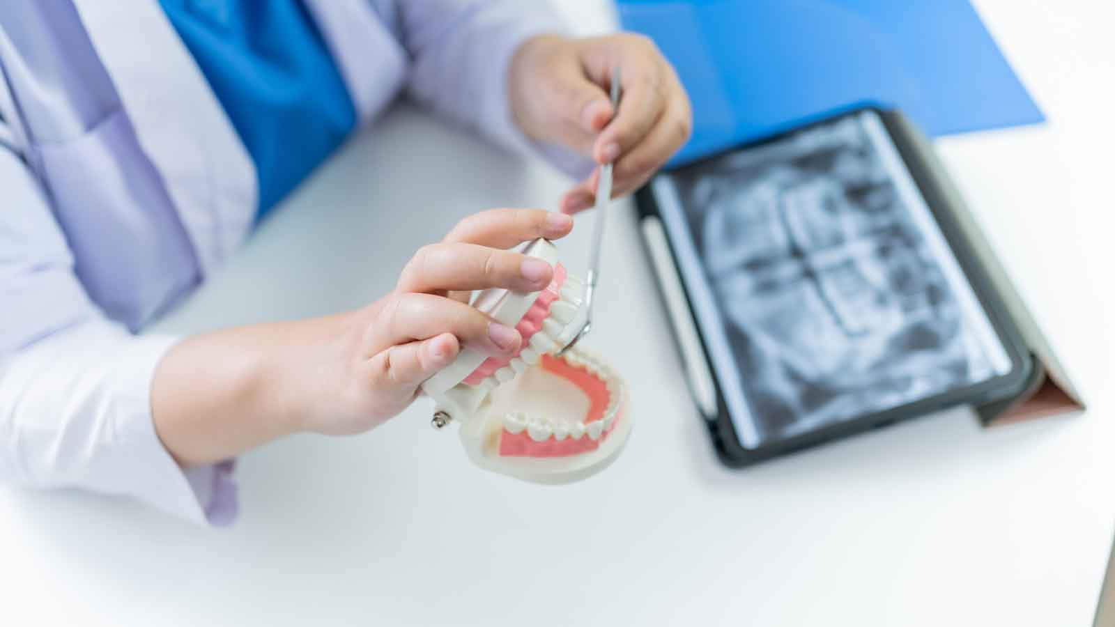 Dental-professional-holding-a-tooth-model-next-to-an-X-ray-(1)
