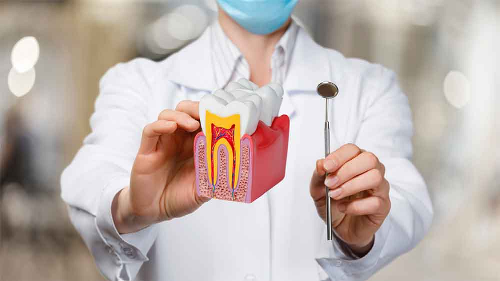 Dentist holding a tooth model showing inner structure and decay.