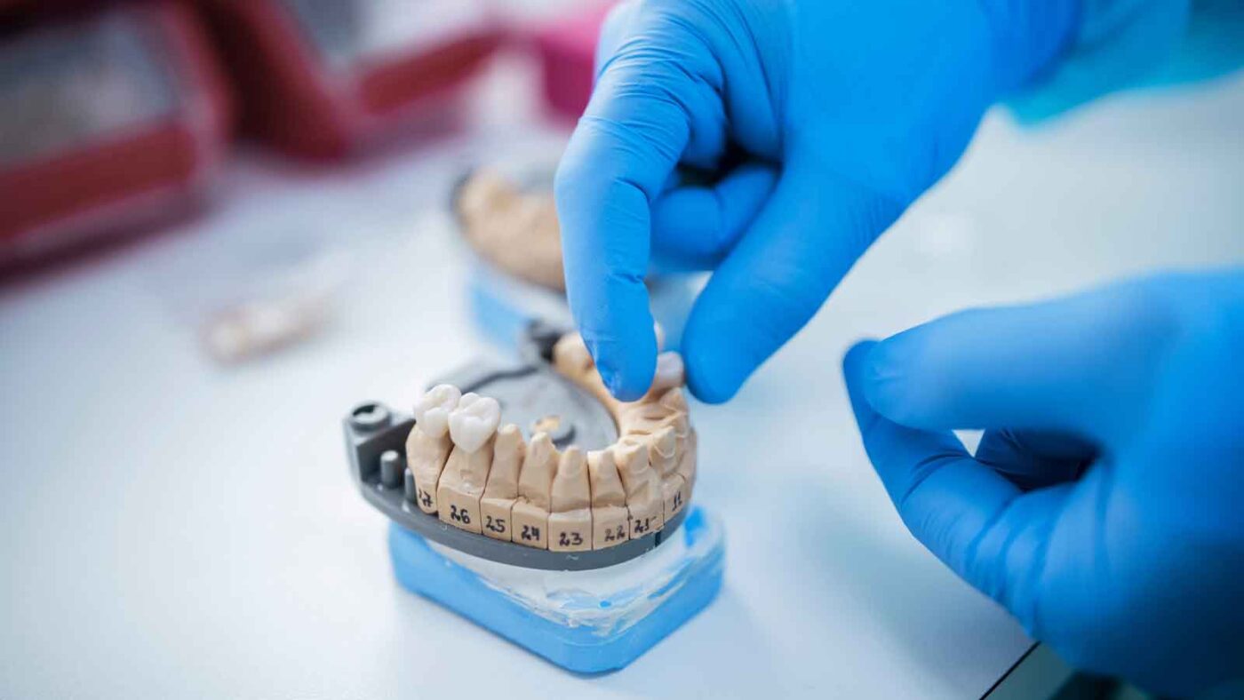 Dental technician adjusts a tooth on a model mold.