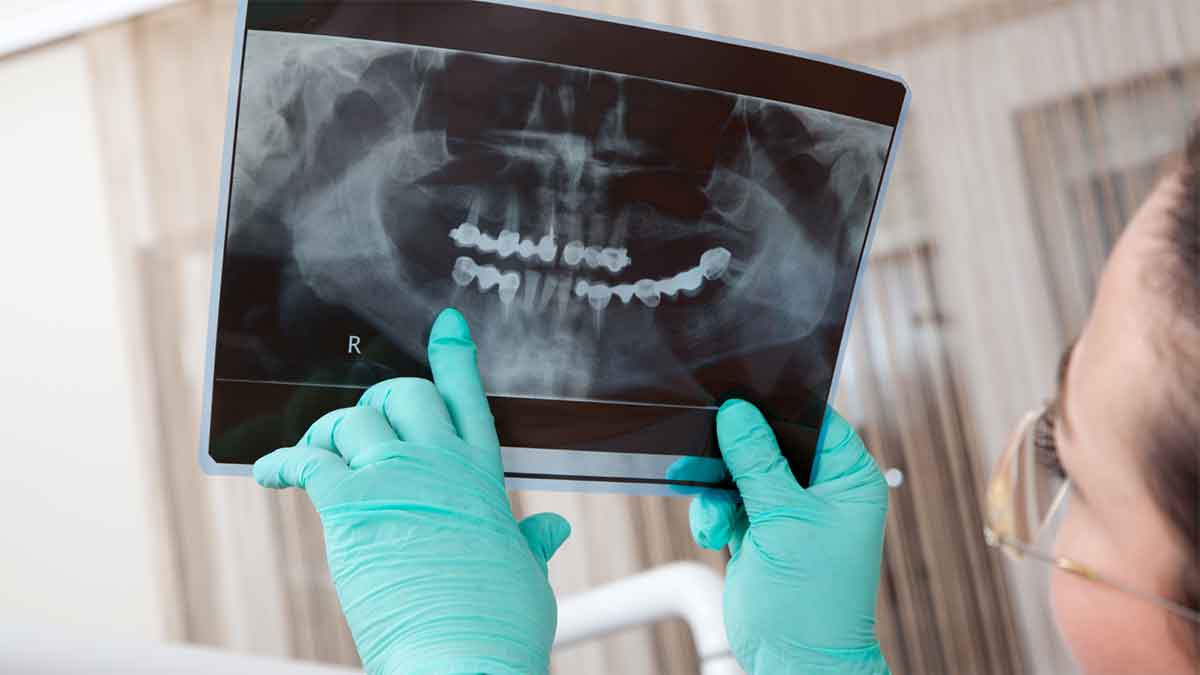 Dentist holding and examining a dental X-ray.