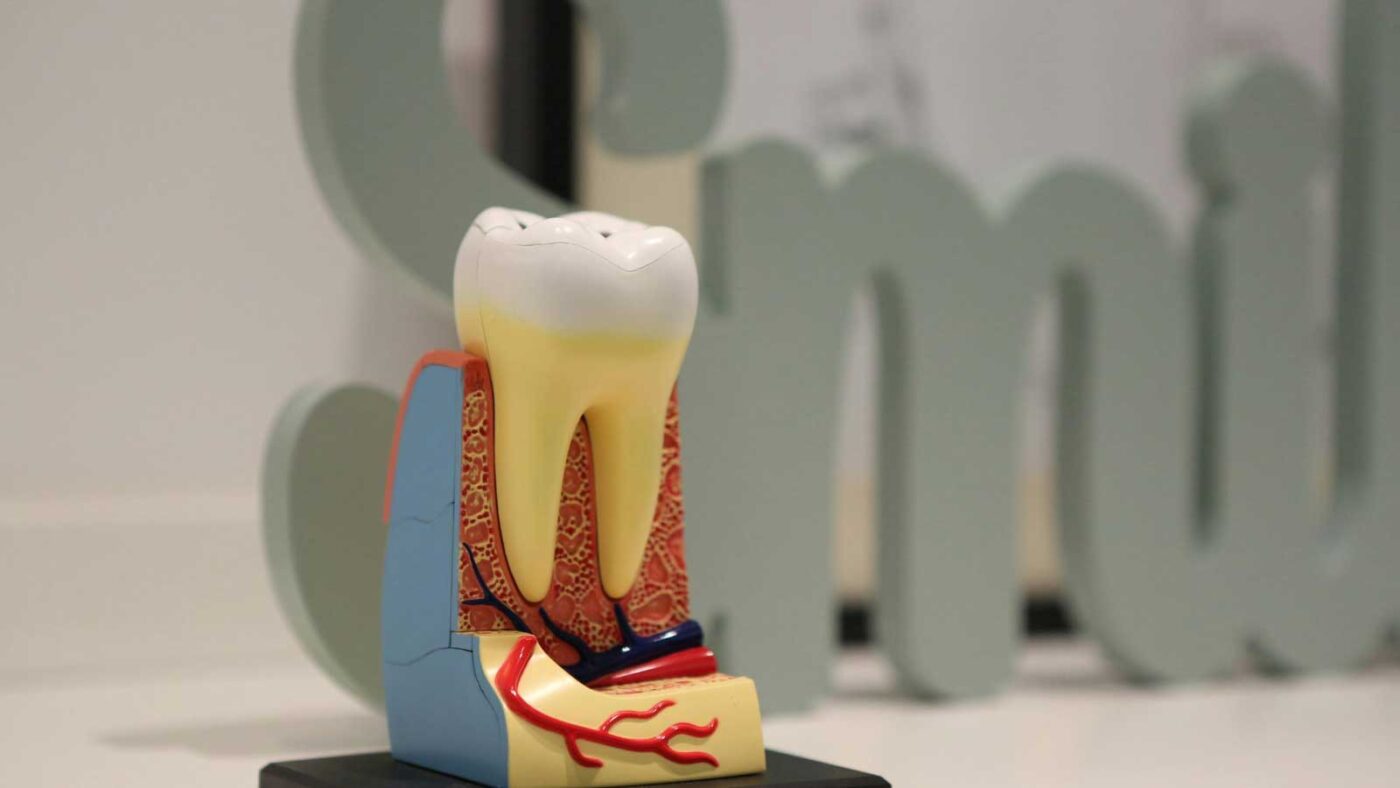 Close-up of a tooth anatomy model showing internal structure.