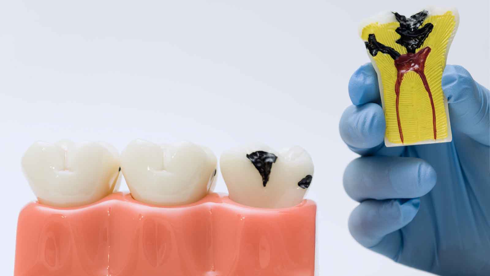 What Is Vital Pulp Therapy and How Does It Save Teeth?